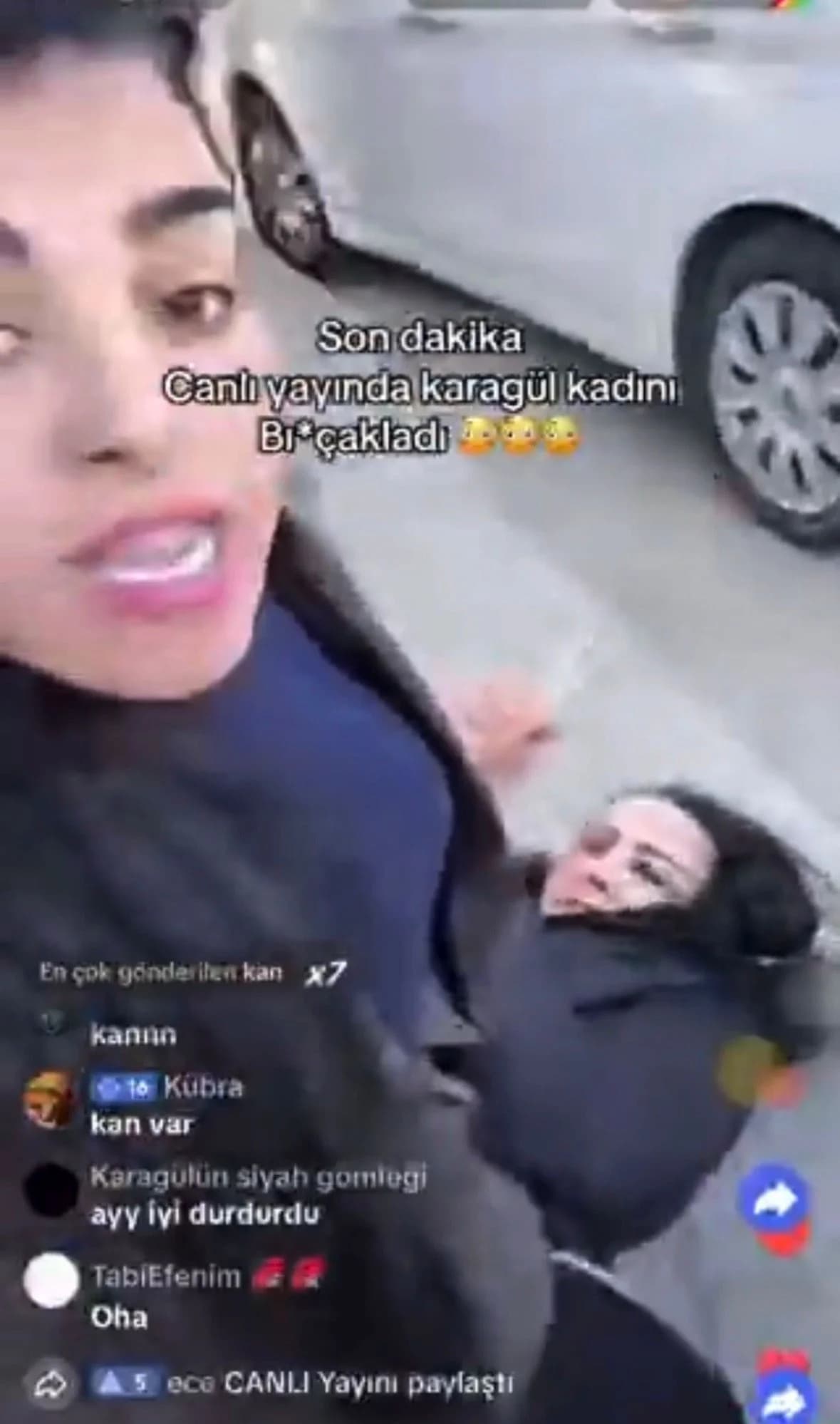 Bursa’da Canlı Yayında Dehşet: Kadının Kulağından Yaralandığı Anlar Kamerada