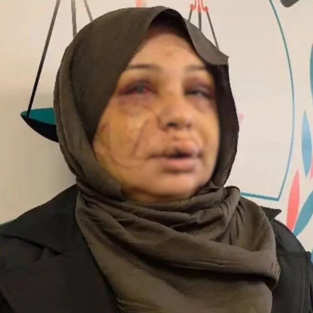 Ankara’da Eşini Yaralayan Polis Memurunun Dosyası Ağır Ceza Mahkemesine Sevk Edildi