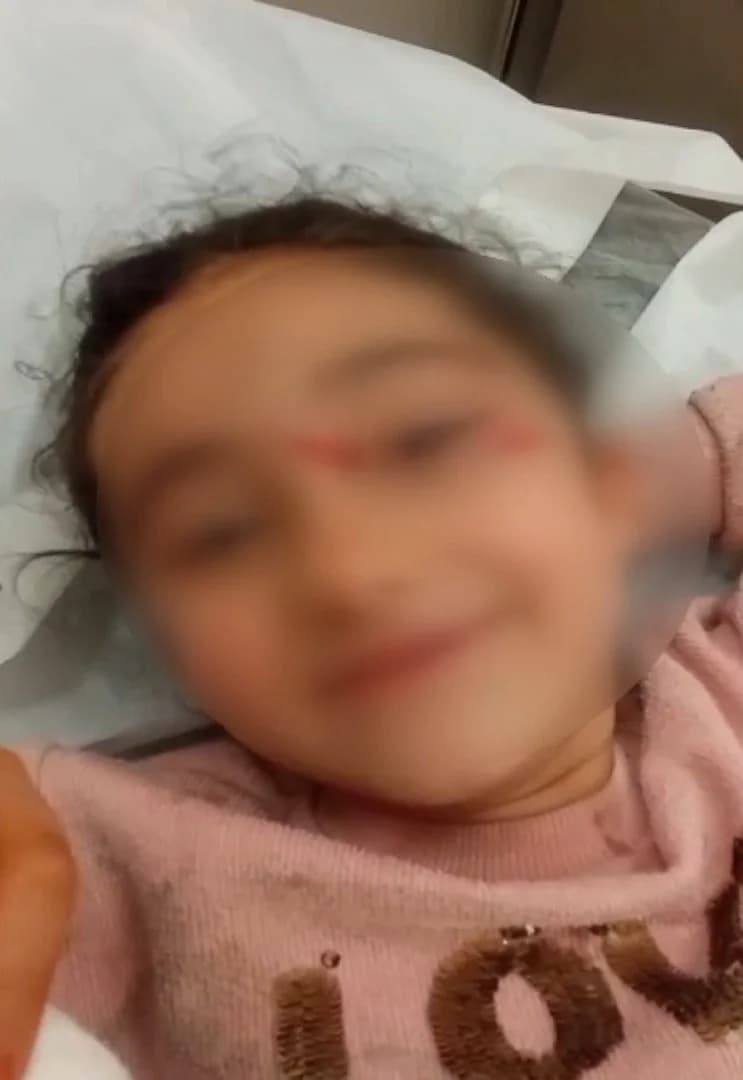 İstanbul Eyüpsultan’da Sokak Köpekleri Küçük Kıza Saldırdı
