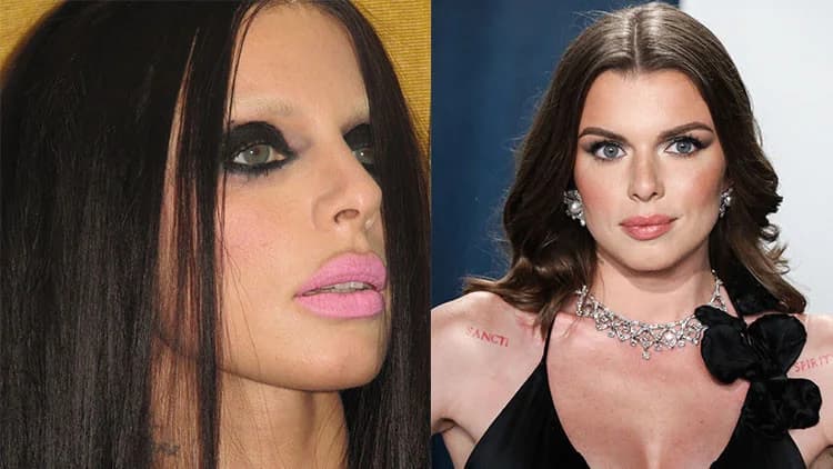 Pişmanlık Dolu Sözler: Estetik Faciası Sonrası Ünlü Modelin Değişimi ve Hayıflanması