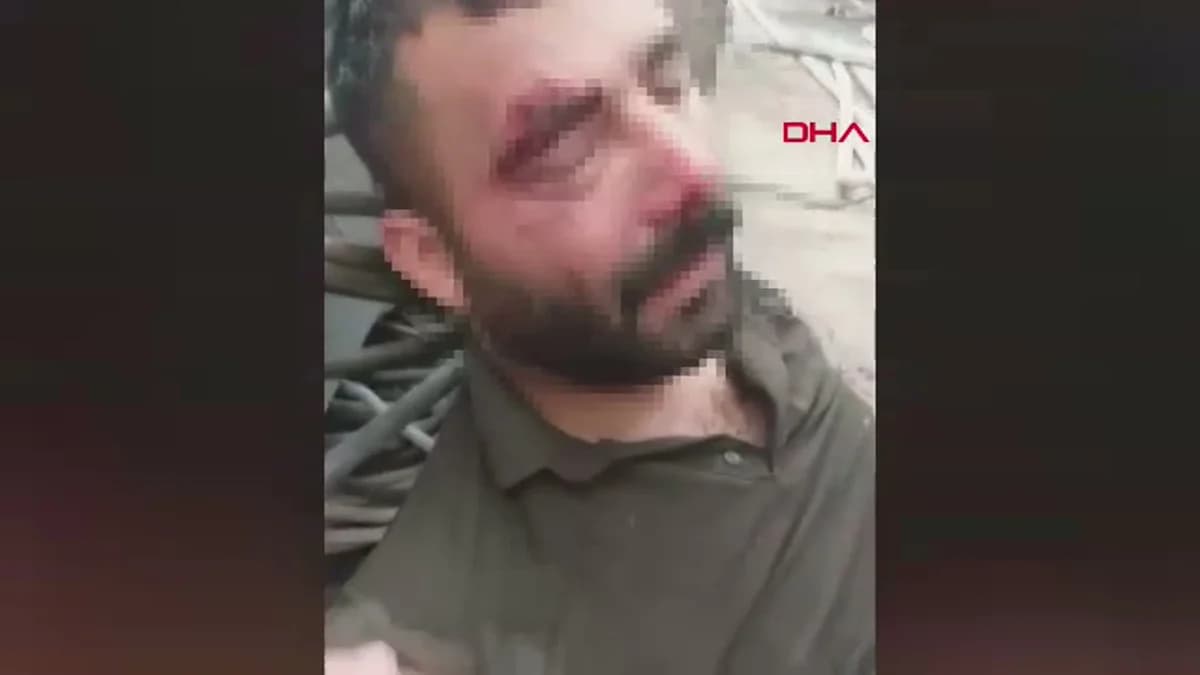 Adana’da Çatıdan Düşen Kaynak Ustasının Hayat Mücadelesi