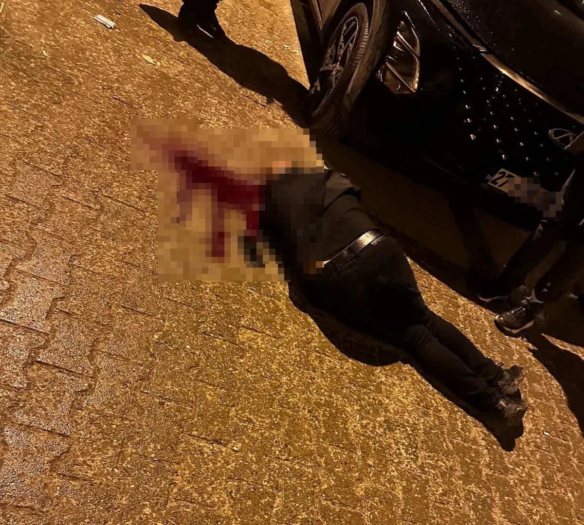 Cizre’de Sokak Ortasında Silahlı Saldırı: Davut A. Ağır Yaralandı