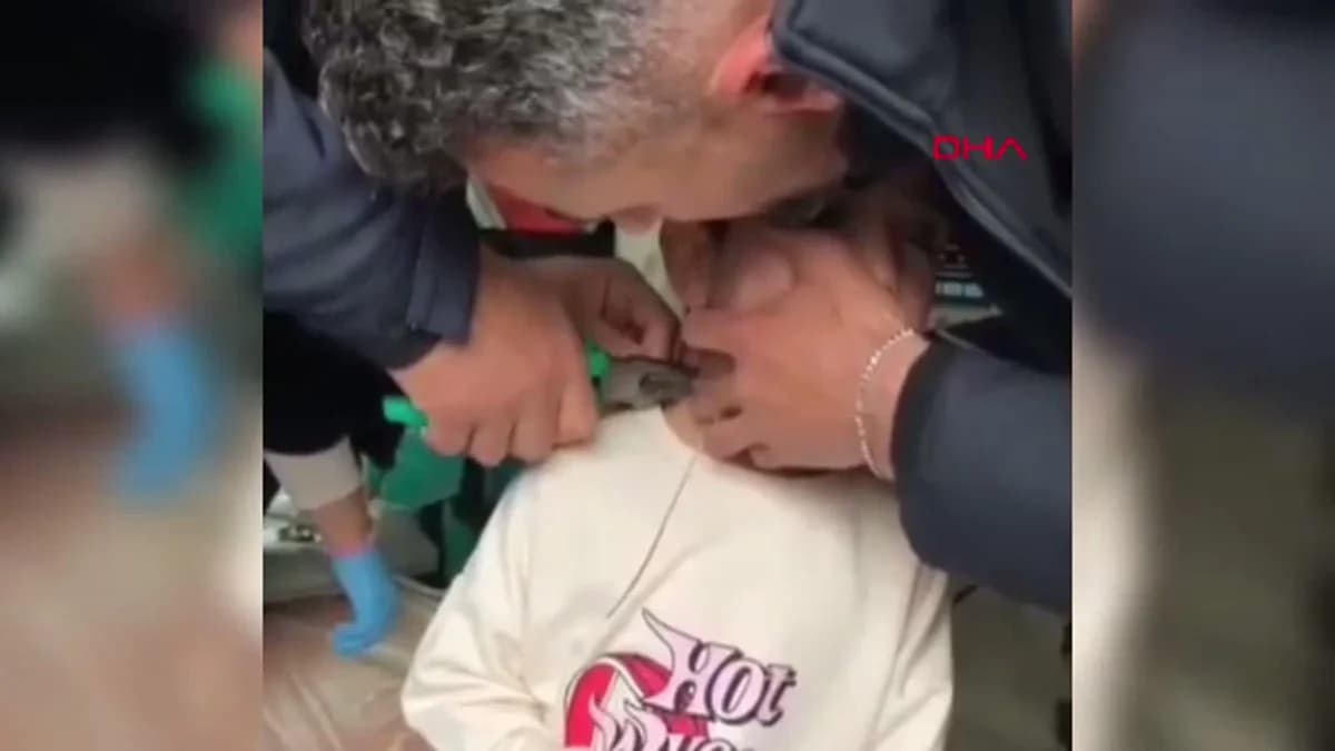 Adıyaman’da Oyun Esnasında Plastikte Kelepçe Takılan Çocuk İtfaiye Ekipleri Tarafından Kurtarıldı