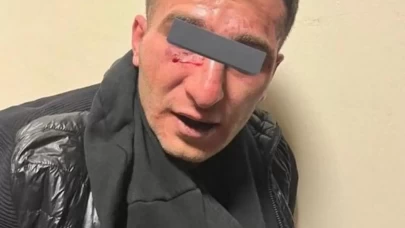 İstanbul’da Şok Olay! Polis Memurlarına Bıçaklı Saldırı Düzenlendi